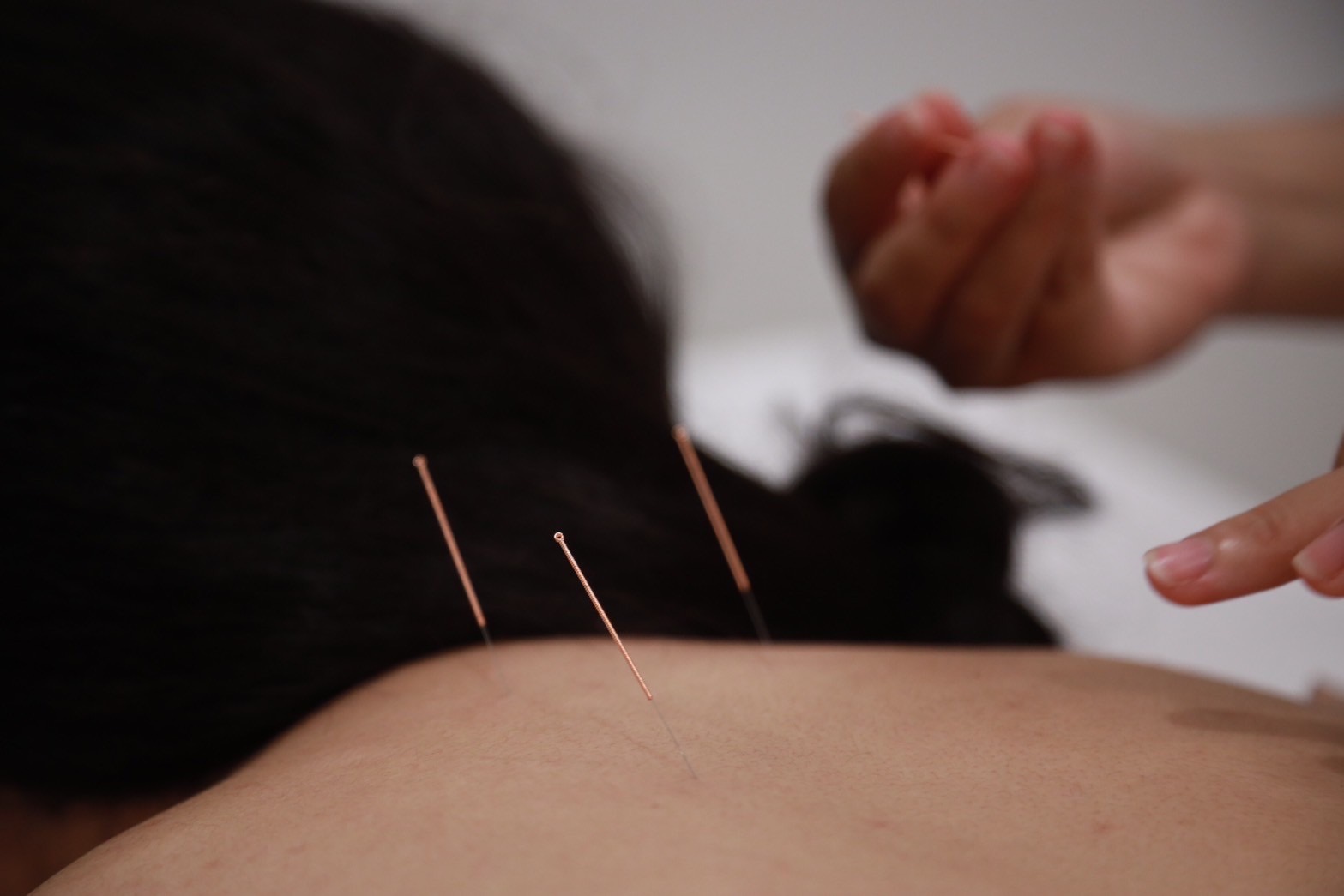 What is Traditional Chinese Medicine?