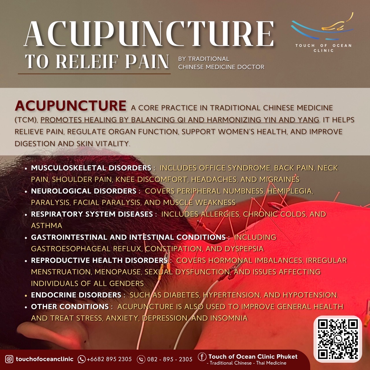 Acupuncture