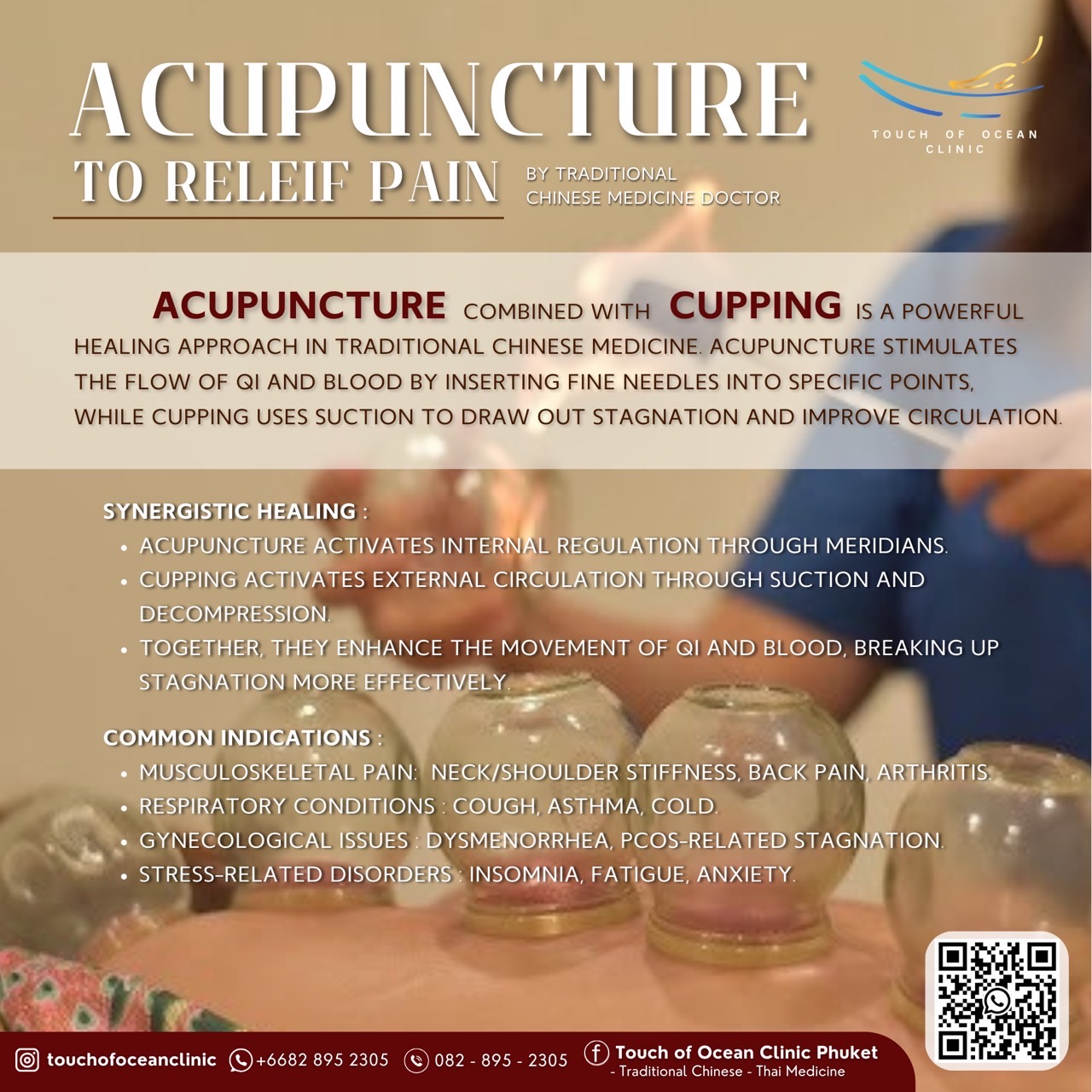 Acupuncture & Cupping