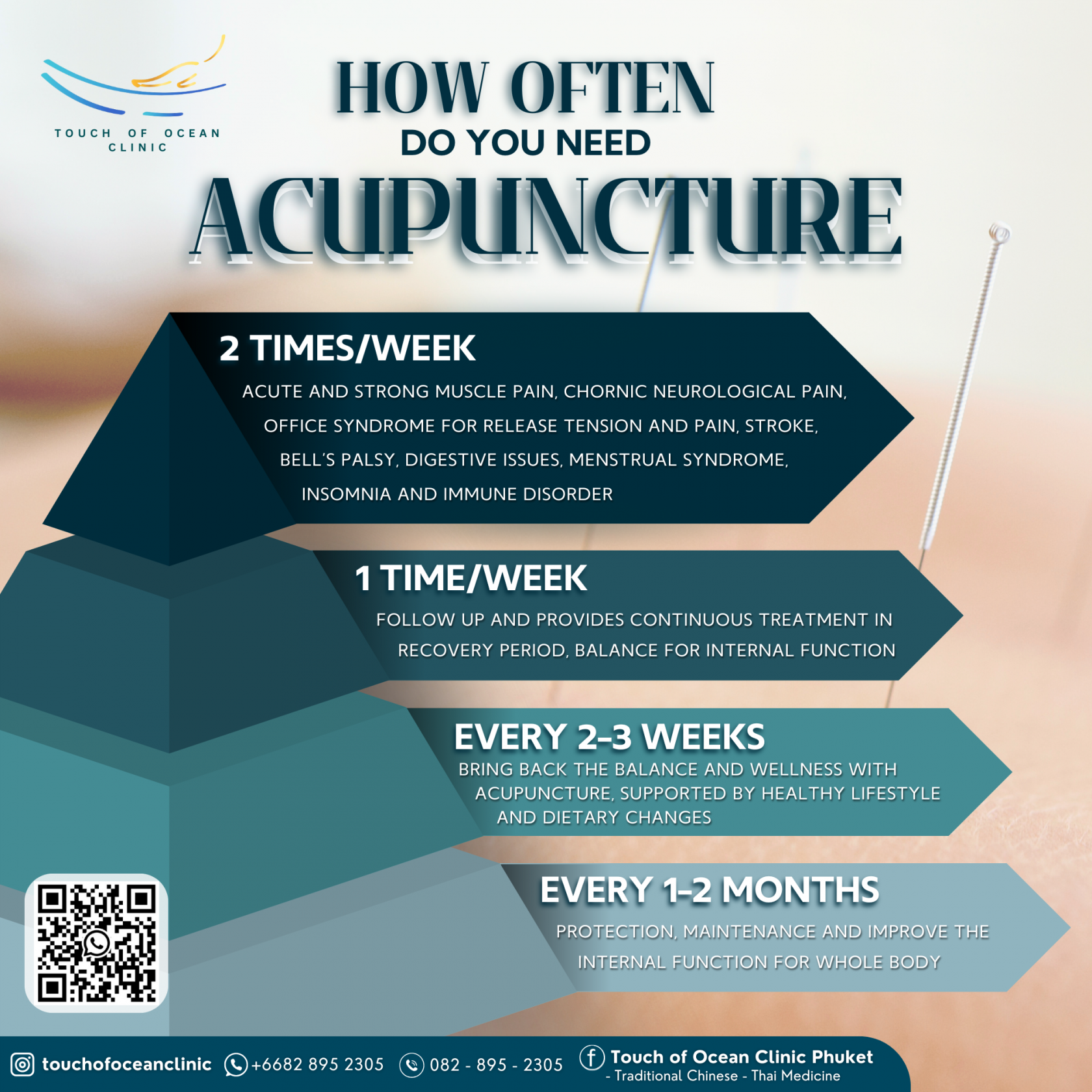 How often do your body need Acupuncture